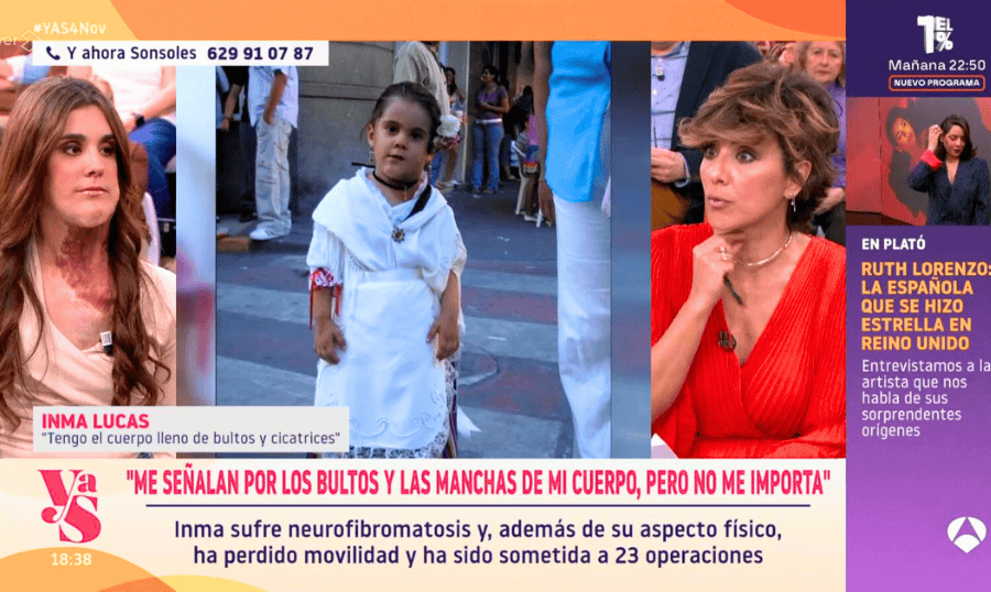 Inma comparte con Sonsoles su historia de superación frente a la neurofibromatosis